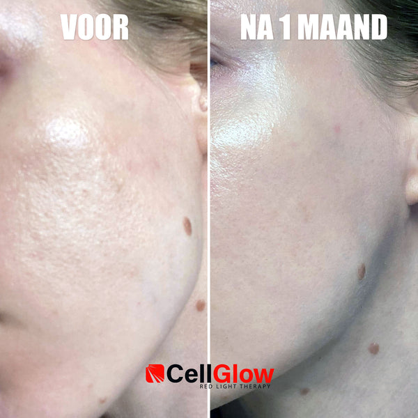 Rood Licht Therapie Masker - Cell Glow (The Original)