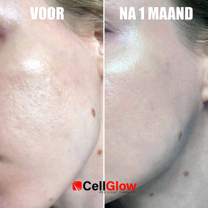 Rood Licht Therapie Masker - Cell Glow (The Original)